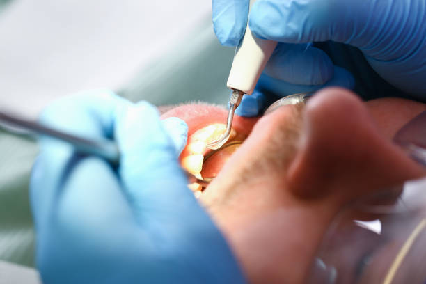 Best Pediatric Emergency Dentist in Wenona, IL