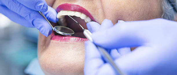 Best Emergency Dentist for Knocked-Out Tooth in Wenona, IL