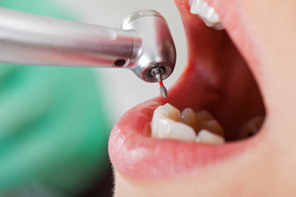 Best Weekend Emergency Dentist in Wenona, IL
